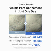 Clinical results: visible pore refinement in just one day, before and after