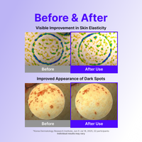 Before and after panels for skin elasticity and the look of dark spots