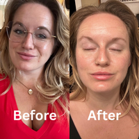 Before and after using the collagen mask