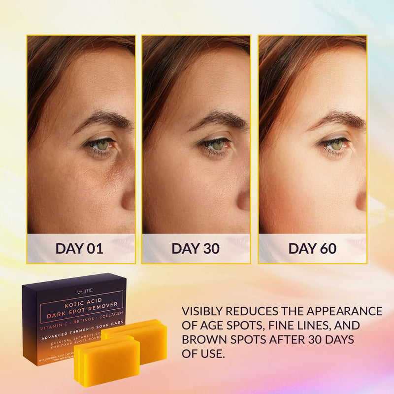 Valitic Kojic Acid Dark Spot Soap Bars