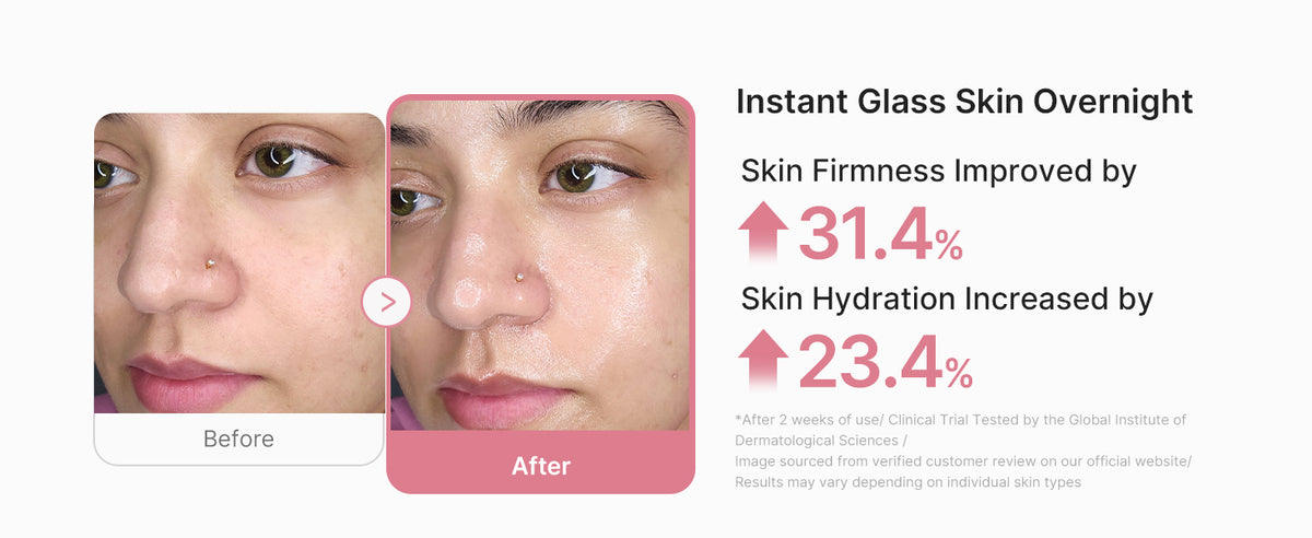 Instant glass skin overnight: skin firmness up 31.4%, hydration up 23.4%, before and after on the face