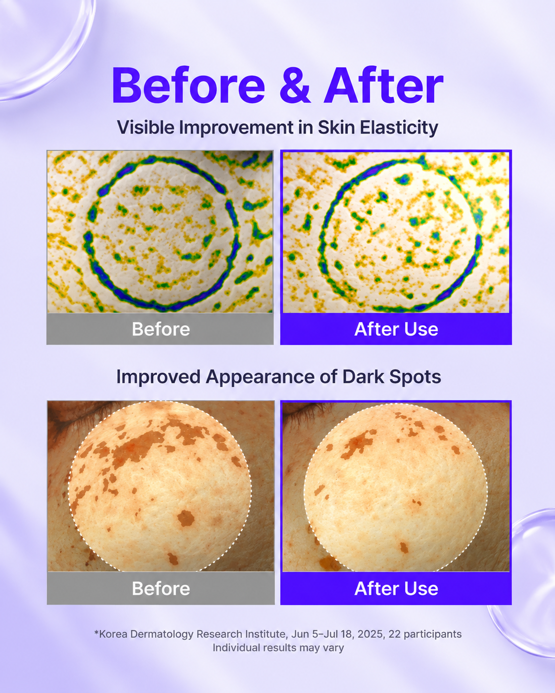 Before and after panels showing skin elasticity and the look of dark spots