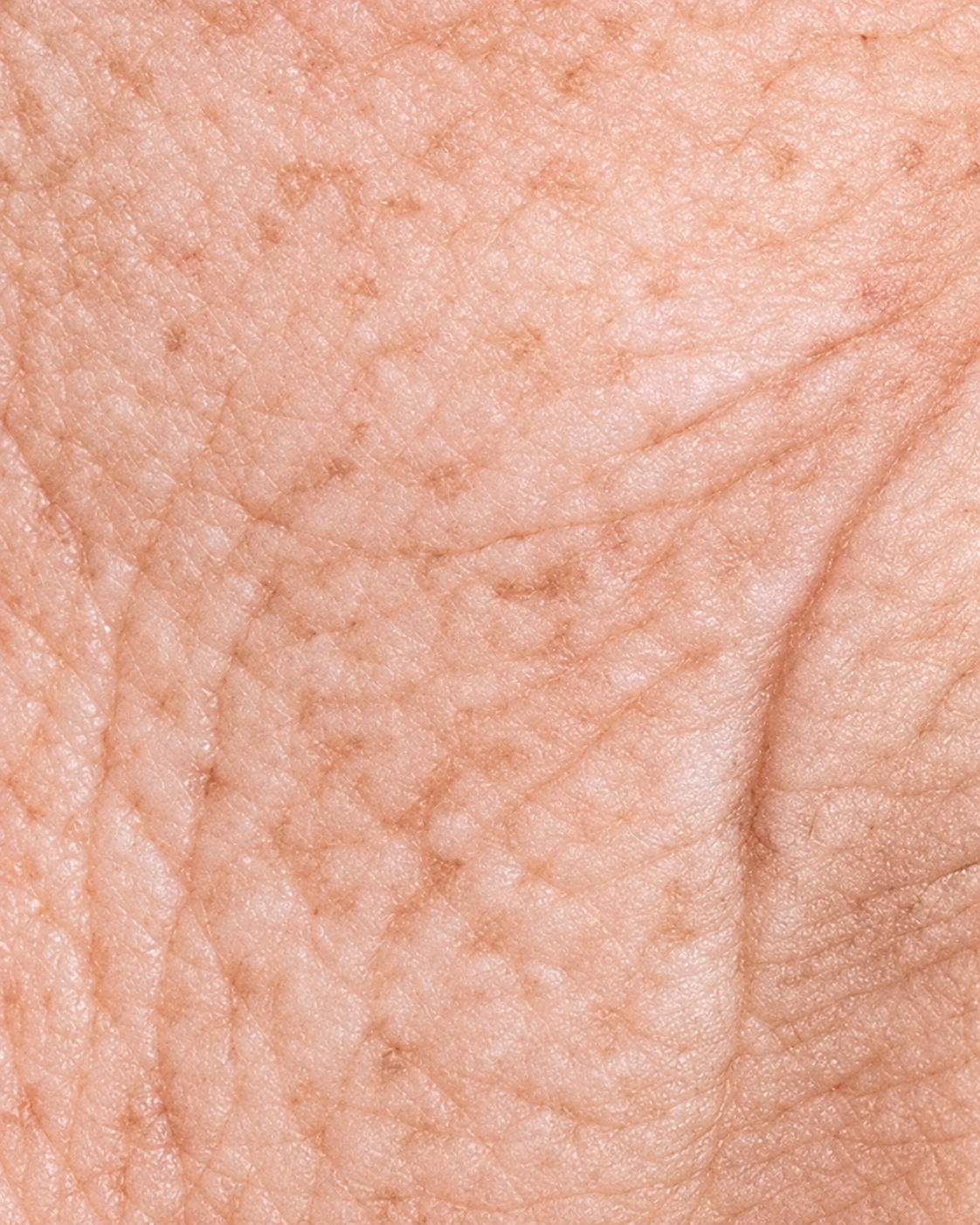 Close-up of skin showing fine lines and wrinkles